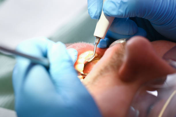 Best Broken Tooth Emergency  in Blaine, WA